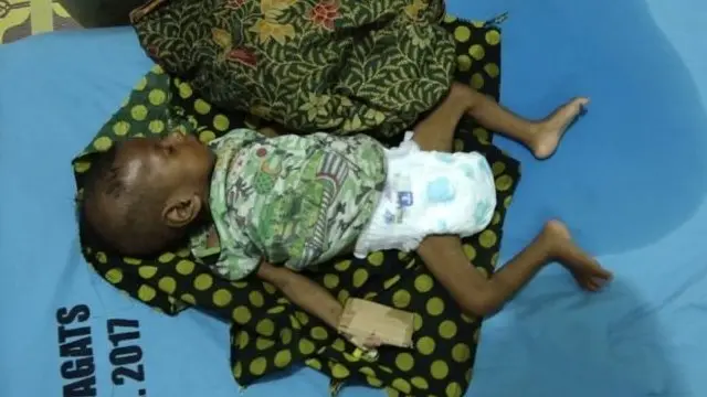 Bencana kesehatan di Asmat, Papua, telah menewaskan 71 anak, sementara 800 orang perlu mendapat pengobatan khusus.
