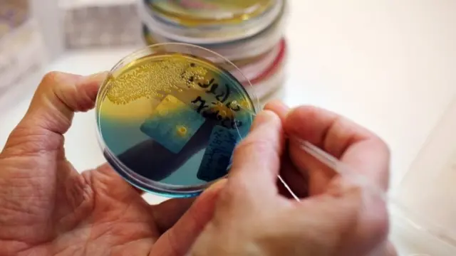 Una prueba de laboratorio de una cepa