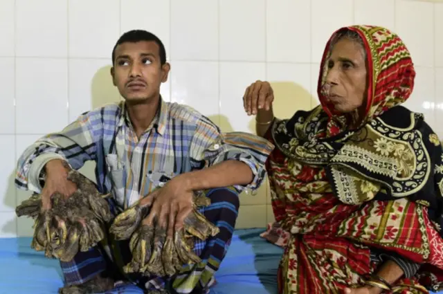 আবুল বাজানদার, অপারেশনের আগে।