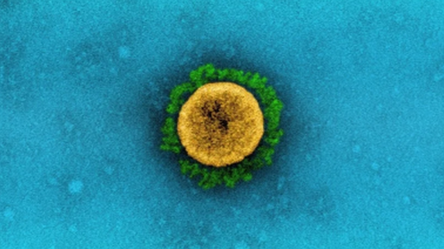 ภาพขยายเชื้อไวรัสโควิด-19 สายพันธุ์แลมบ์ดา ซึ่งพบครั้งแรกในประเทศเปรู