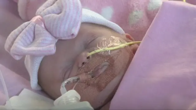 3D प्रिंटच्या साहाय्याने येत्या काळात तिच्या हृदयाभोवती एक मऊ कवच बसवण्यात येणार आहे