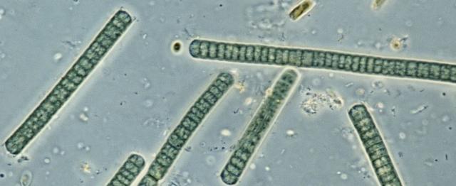 Oscillatoria, genus cyanobacterium, blue-green algae, seen under a microscope.