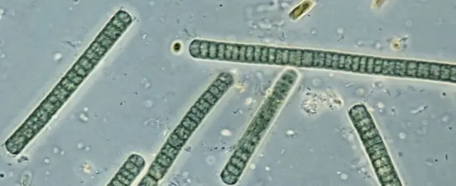 Oscillatoria, uma cianobactéria, vista ao microscópio