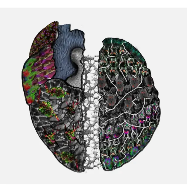 BRITISH HEART FOUNDATION, jantung, pembuluh darah, kompetisi