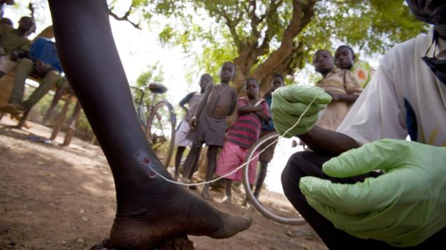 Açãoaviator site de apostasaúde contra DTNsaviator site de apostaGana