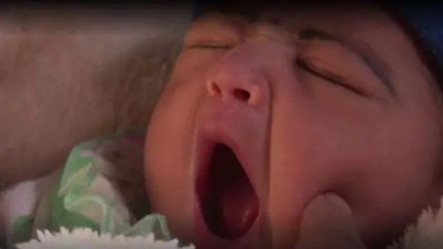 এ ধরণের শত শিশুর জন্ম হয়েছে শেরবানুর হাত ধরে