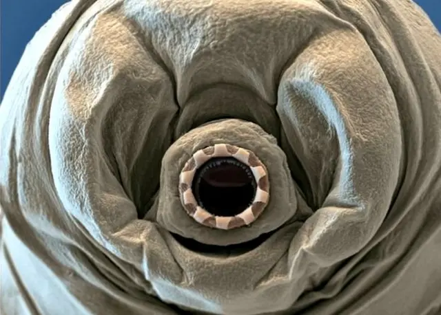 टार्डिग्रेड