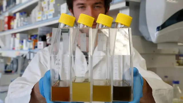 आईवीएफ़