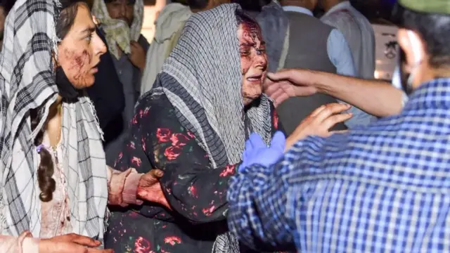 বিমানবন্দর থেকে আহত এক নারীকে সরিয়ে নেয়া হচ্ছে।