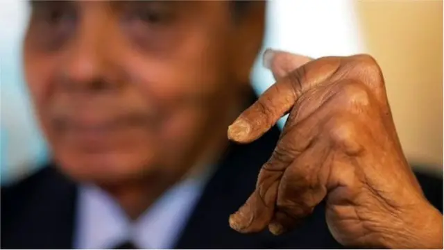 గోళ్లు పెంచడం వల్ల వేళ్లు కదిలించలేకపోయారు