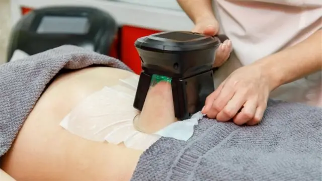Cryolipolysis hugandisha mafuta kama njia ya kuyapunguza