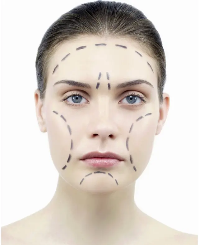 प्लास्टिक सर्जरी