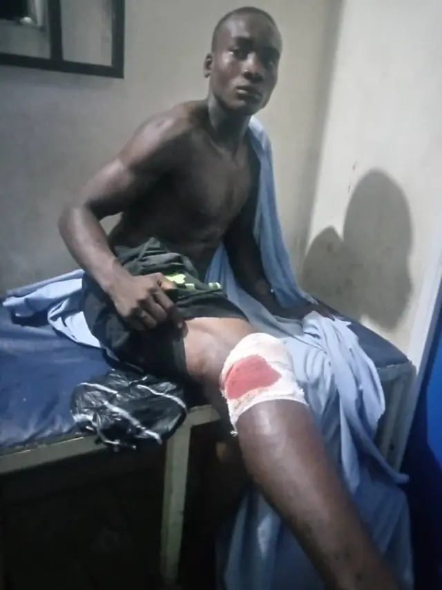 Man wey bullet hit for di attack
