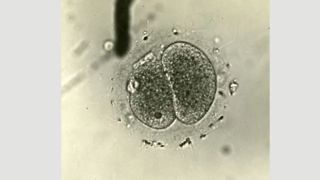 فرٹیلائز ایگ