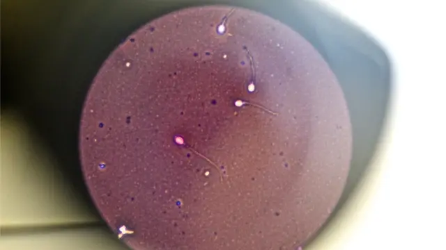 Ihe eserese na-egosi etu nwaanyị sị atụrụ ime