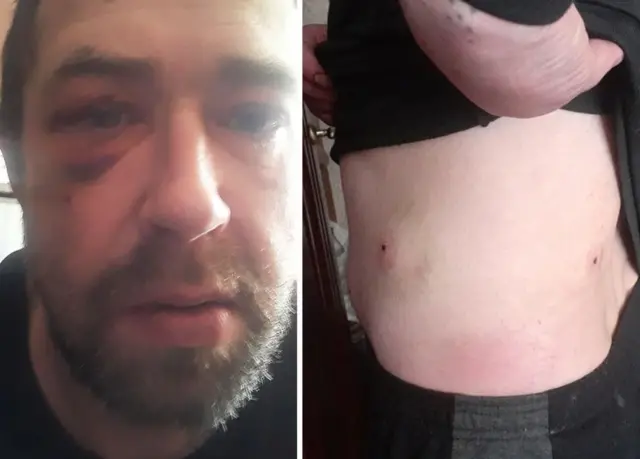 Иван Скибанинг қўлга олинган кунидаги кўриниши ва баданидаги ўқ теккан жой