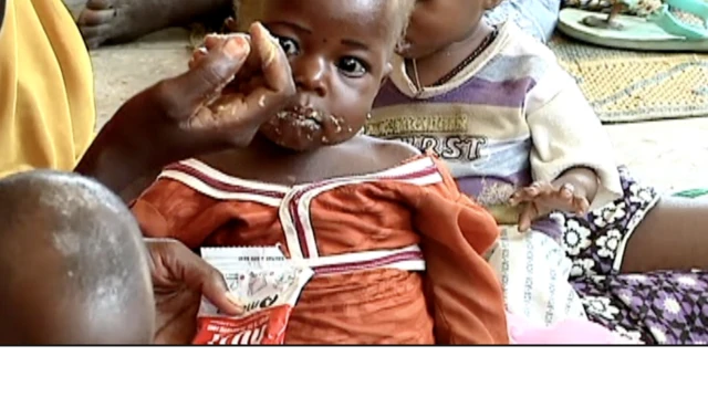 malnutrition case plenti for North pass oda part of di kontri