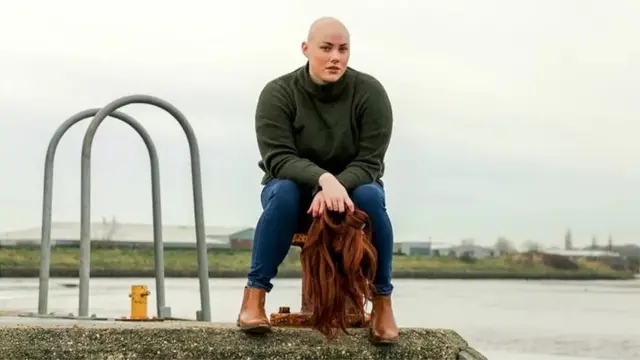 Laura Mathias travaille avec des organisations caritatives pour sensibiliser sur l'alopécie.