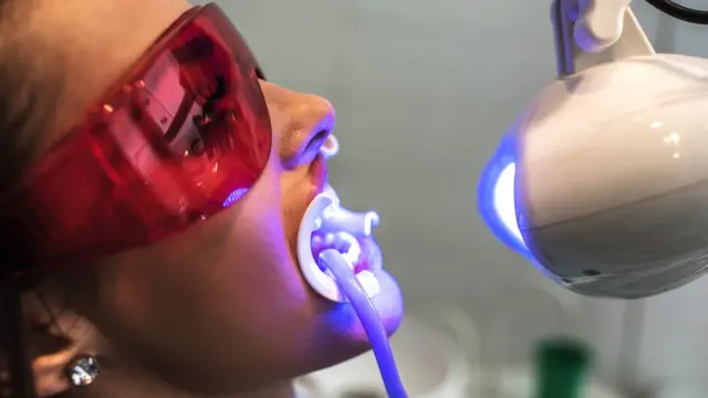 Профессиональные методы отбеливания зубов, как правило, приносят лучший результат, чем домашние способы