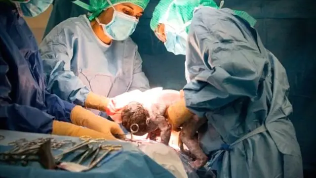 प्रसूती