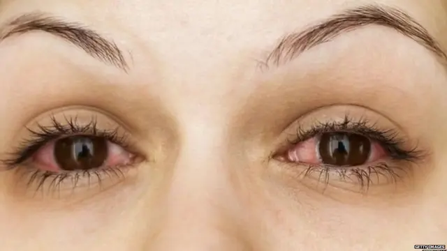 ਬਲੈਕ ਫੰਗਸ