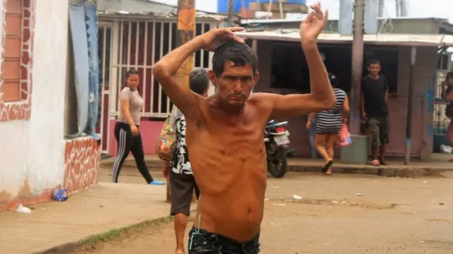 Eduardo Gotera padece del Mal de San Vito