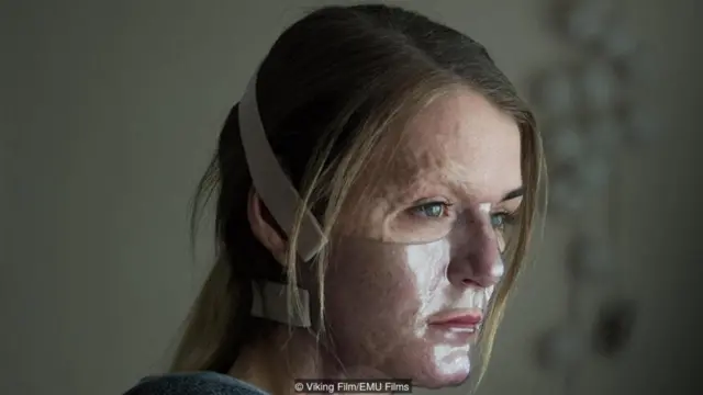 Vicky Night, yang menderita luka bakar ketiga dan keempat saat kecil, memulai debut aktingnya di film drama berpengaruh, Dirty God