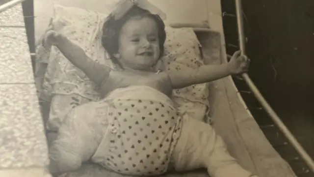 Cristina con el yeso para tratar la displasia de caderas