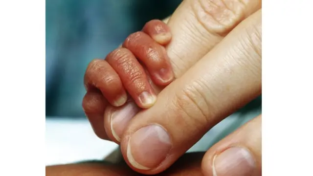 గర్భాశయ మార్పిడి