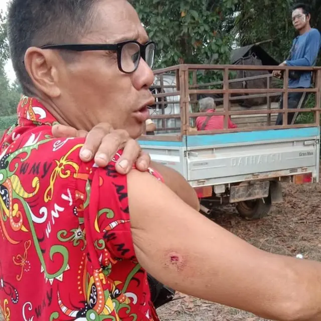 Seorang warga memperlihatkan luka di lengannya usai bentrokan dengan aparat polisi.