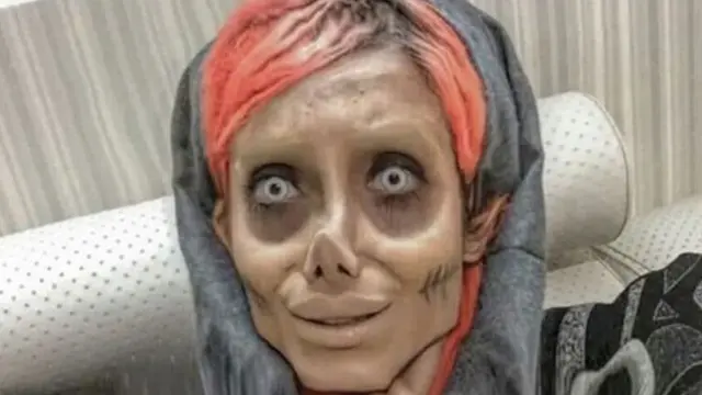 Wanaharakati wa haki za binadamu wanasema kwamba mtumiaji wa mtandao wa INstagram Fatemeh Khishvand ametumika kama mfano na utawala wa Iran.