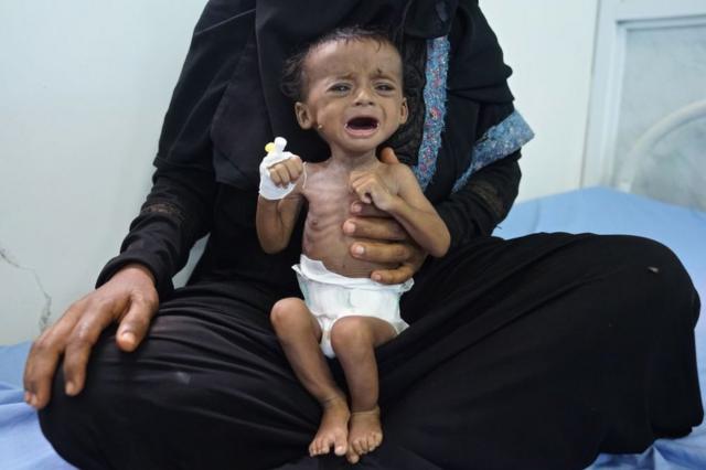 طفل يمني مع والداته