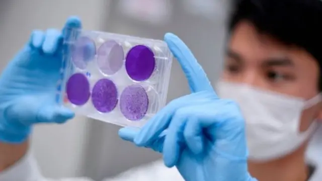 கொரோனா வைரஸ்