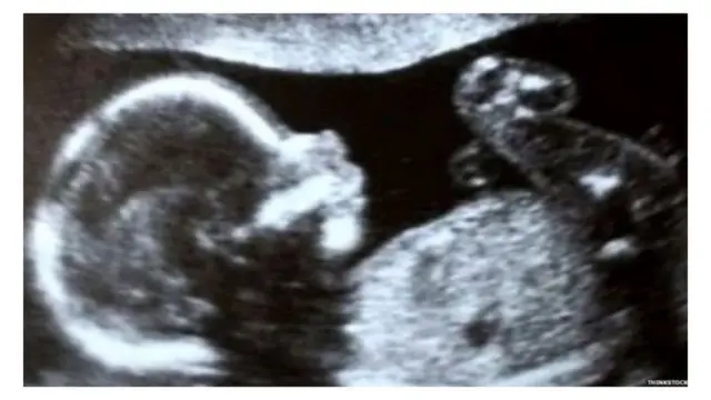 सांकेतिक तस्वीर