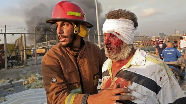 Liban : violente explosion à Beyrouth, au moins 50 morts et plus de 2500 blessés