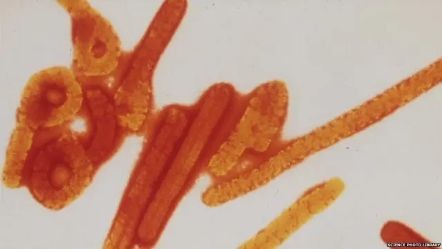 Ebola dey give pesin high fever and dey destroy di central nervous system