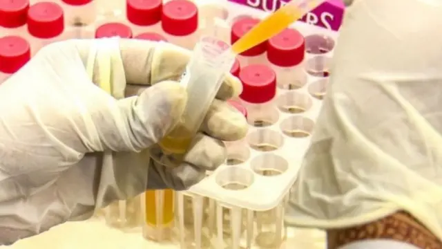 पाकिस्तान अभी तक वैक्सीन की ख़रीददारी का समझौता क्यों नहीं कर पाया?