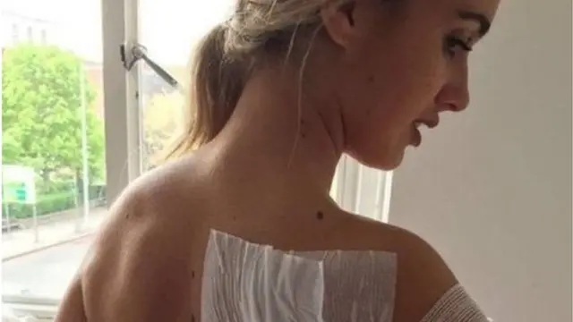 লন্ডনে নৈশক্লাবে এসিড হামলার শিকারন হন ইসোবেলা ফ্রেসার।