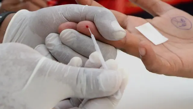 హెచ్ఐవీ-ఎయిడ్స్