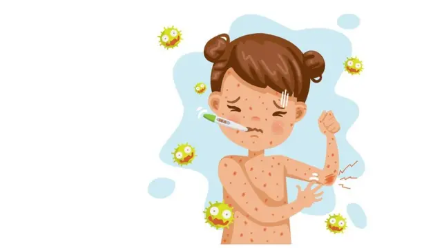 জলবসন্ত