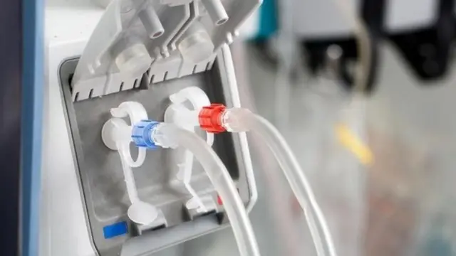 ट्रान्सप्लॅंट