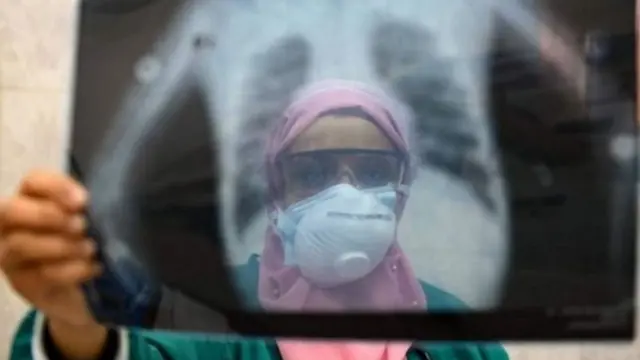 कोरोना वायरस