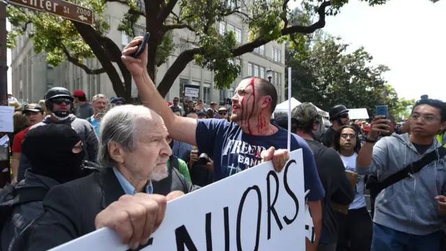 一名男子不顾伤势，在示威现场拍照。