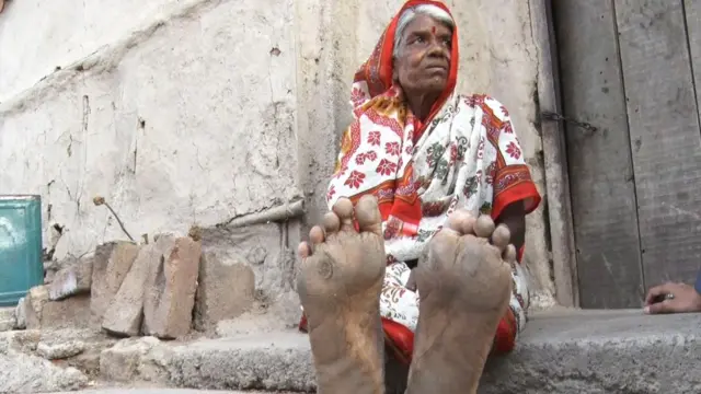 पायाला असे घट्टे पडले आहेत