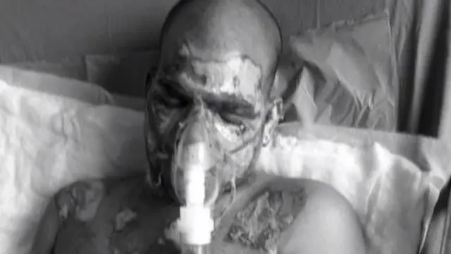 சிகிச்சை பெற்றுவரும் ராஜேஷ்