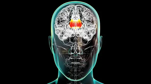 Ilustración del cerebro con el cuerpo calloso