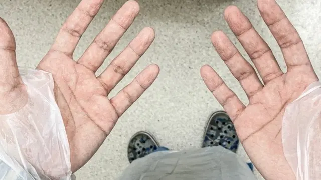 이 간호사는 의료진들의 장갑을 벗겨보면 땀이 흥건하다고 했다. 손은 땀에 불어 주름투성이다