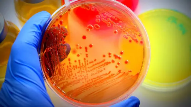 Un examen microbiológico