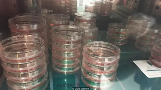 Lancaster's goal is to turn human skin into functioning brain cells