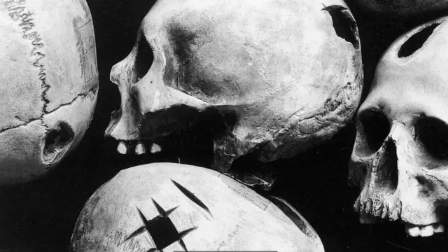 جمجمههای سوراخ شده در پرو